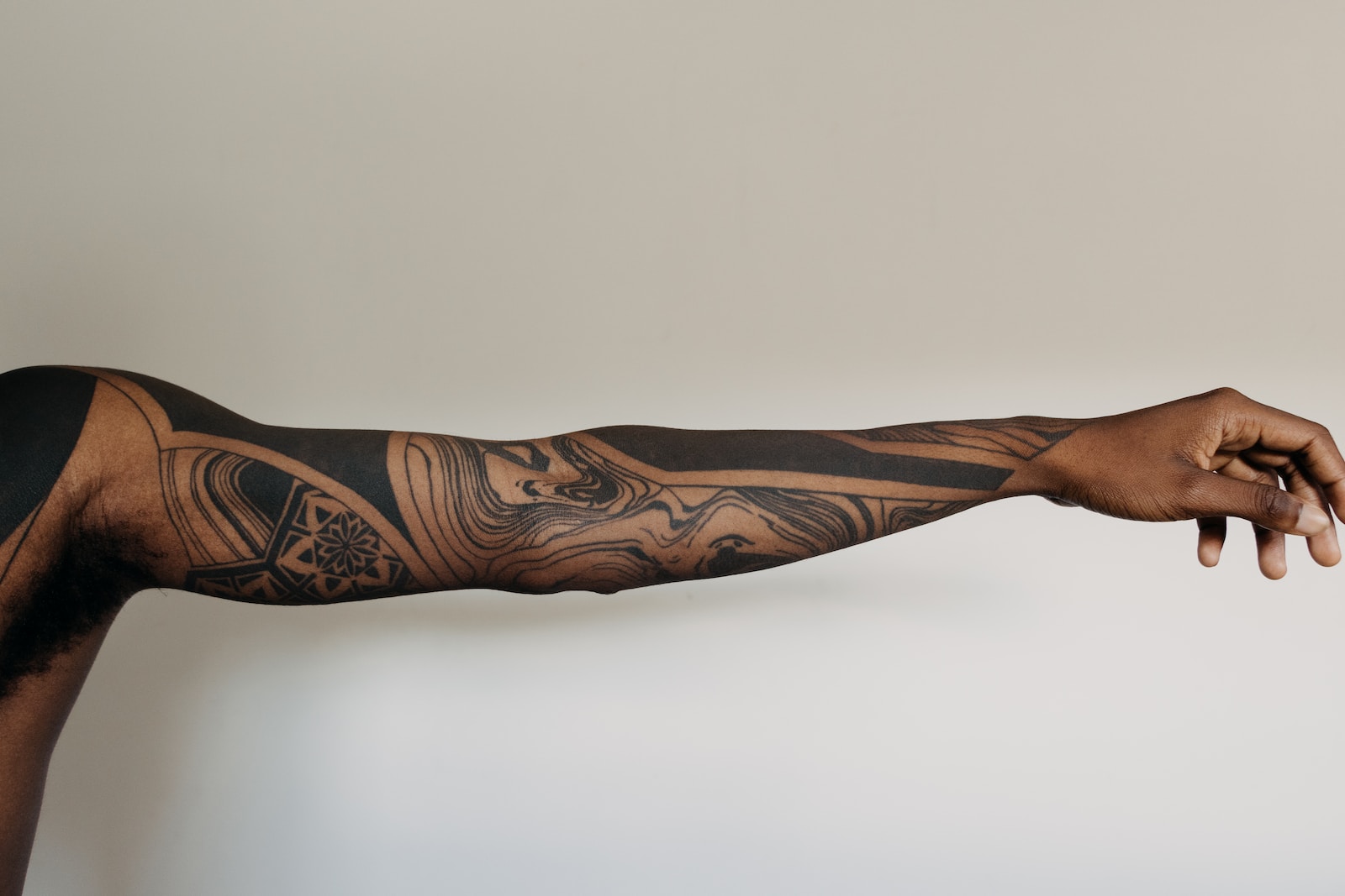 radial artery